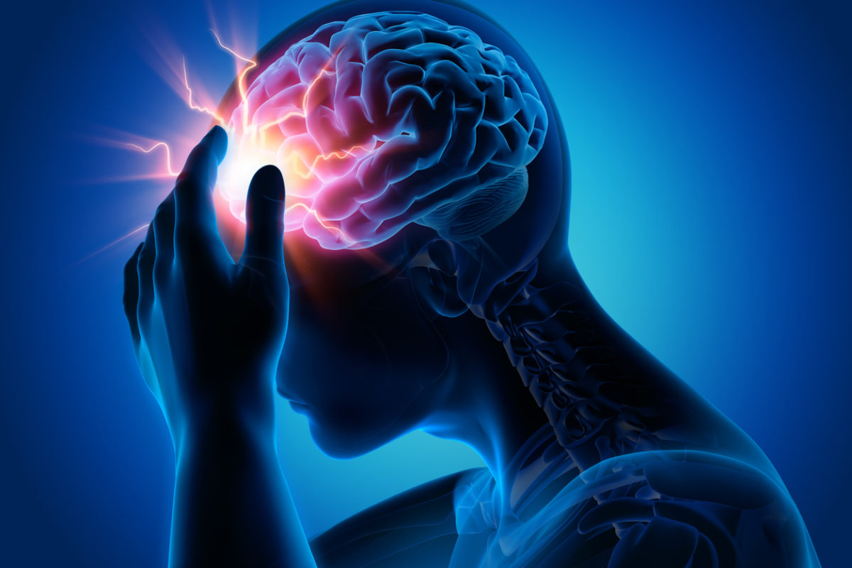 x-ray image of migraine pain