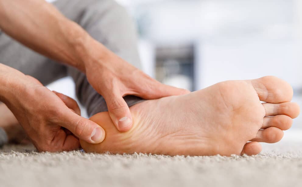 Understanding the Plantar Fasciitis VA Rating Veterans Guardian