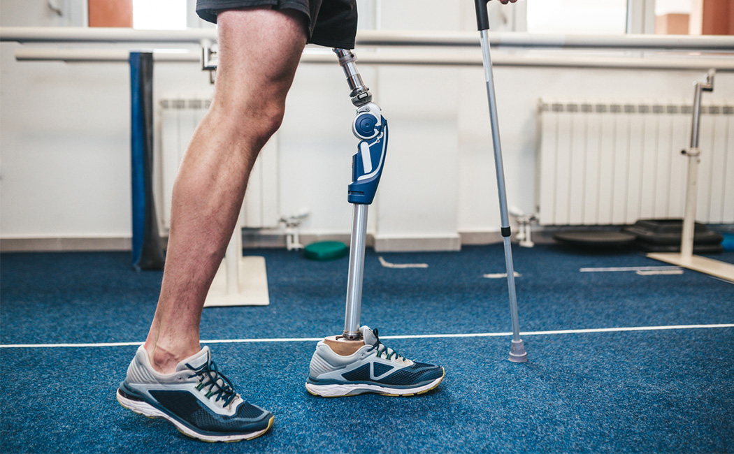 The Latest in Prosthetic Technology for Amputee Veterans